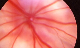 反復投与毒性試験：眼科学的検査での眼底写真
